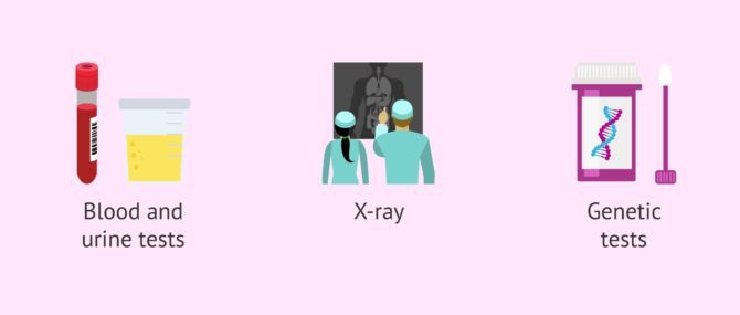 Imagen: What tests help in the diagnosis of CAH?