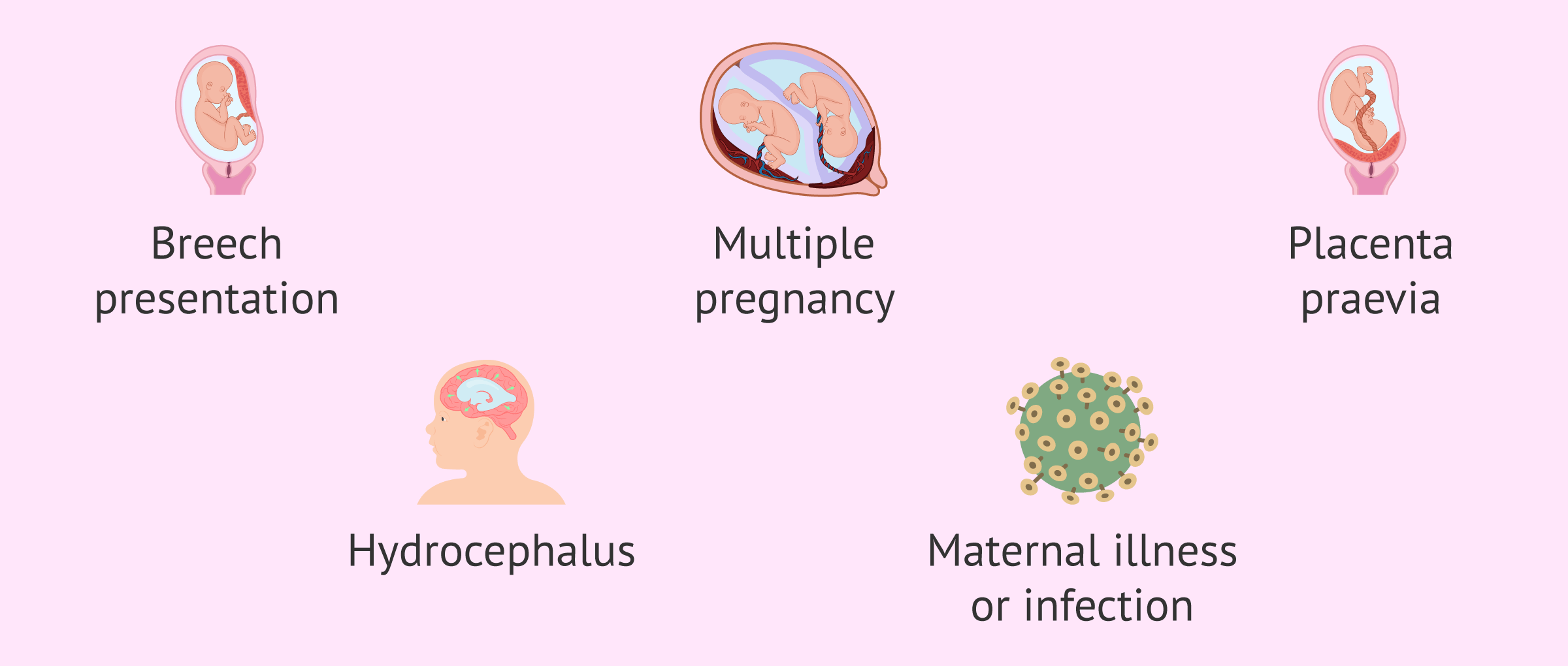 When is it indicated to schedule a caesarean section?