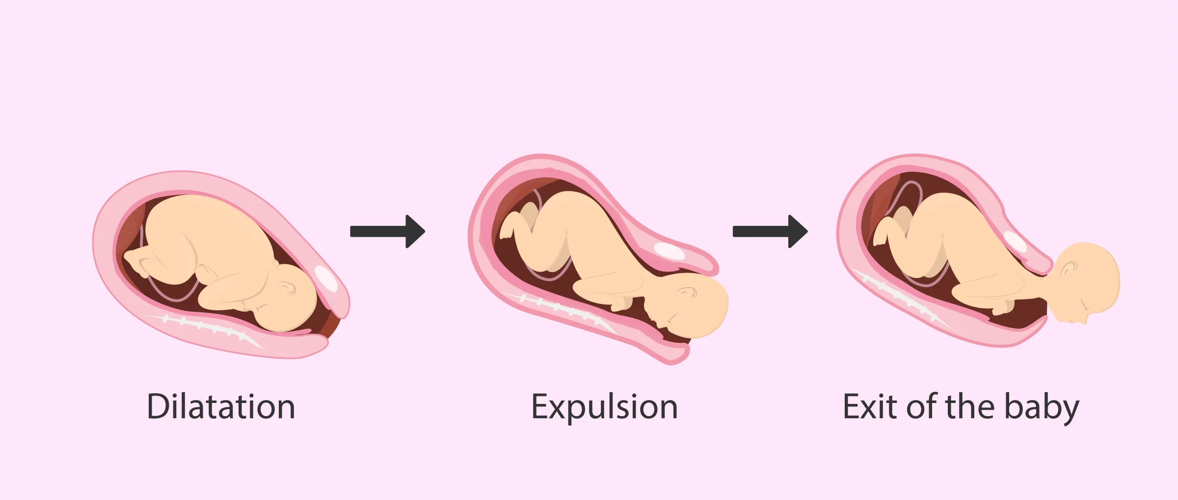 Natural birth