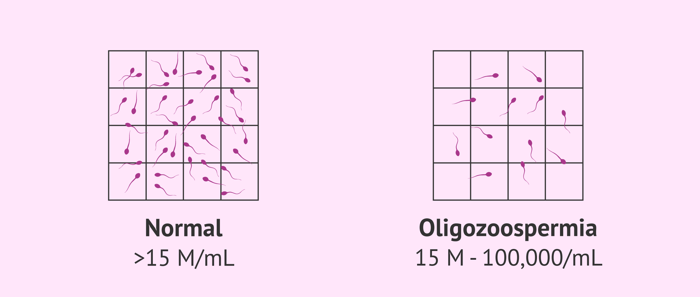 Normal semen sample and oligozoospermic sample