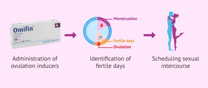 Imagen: Ovulation-inducing drugs and timed intercourse in women with PCOS