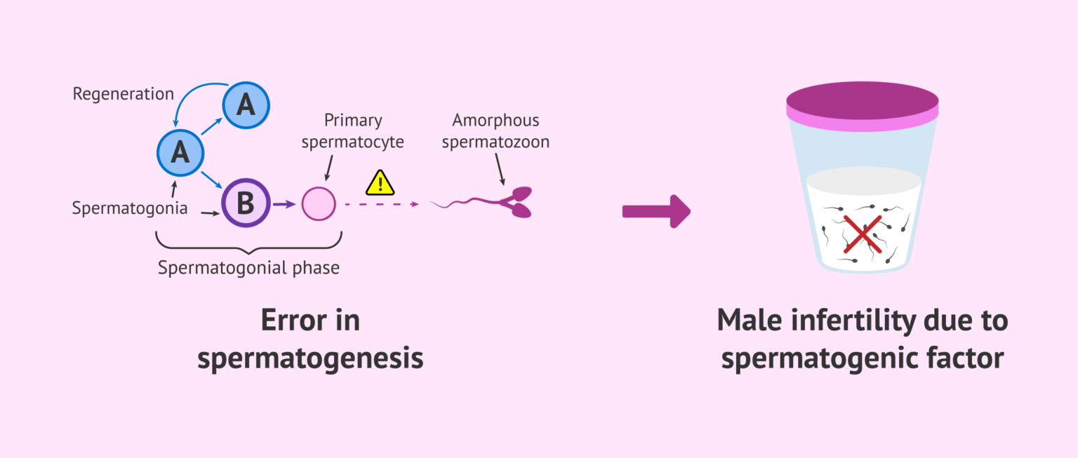 Sperm Condition List of Sperm Disorders that Cause Male Infertility
