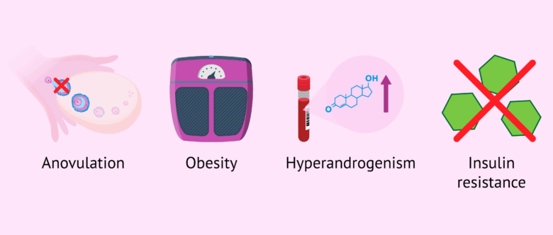 Factors associated with PCOS