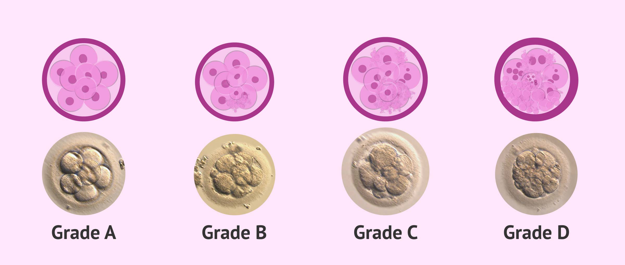 Embryo grading