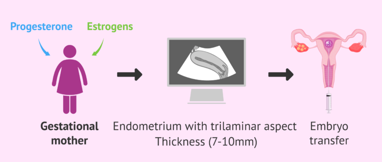 Imagen: Endometrial preparation and embryo transfer