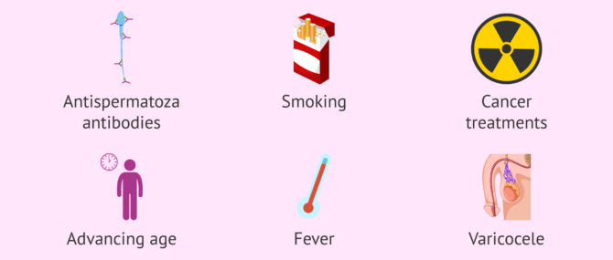 Imagen: Causes of astenozoospermia