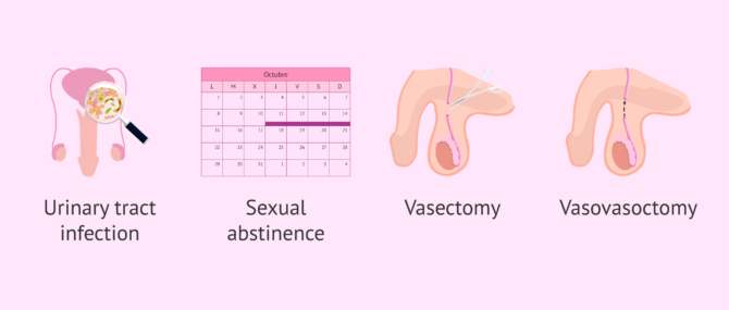 Imagen: Why does leukospermia occur?