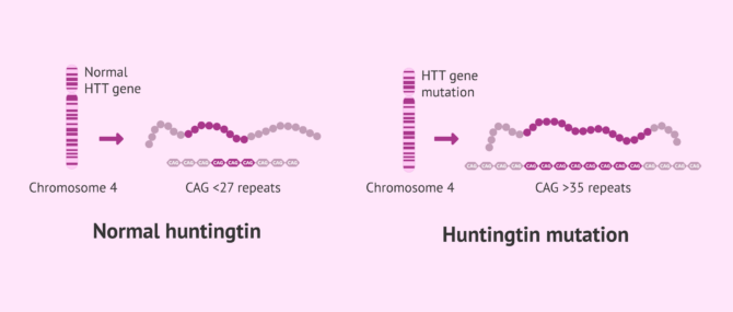 What is Huntington's disease and can it be prevented with PGD?