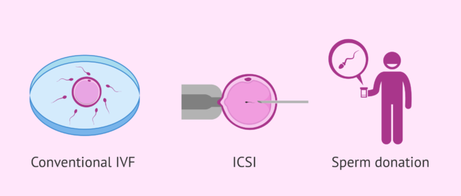 Imagen: Solutions for successful pregnancy with astenozoospermia