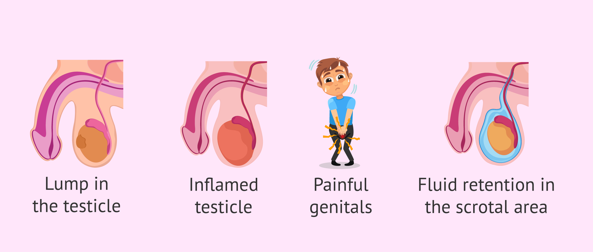 Possible symptoms of testicular cancer