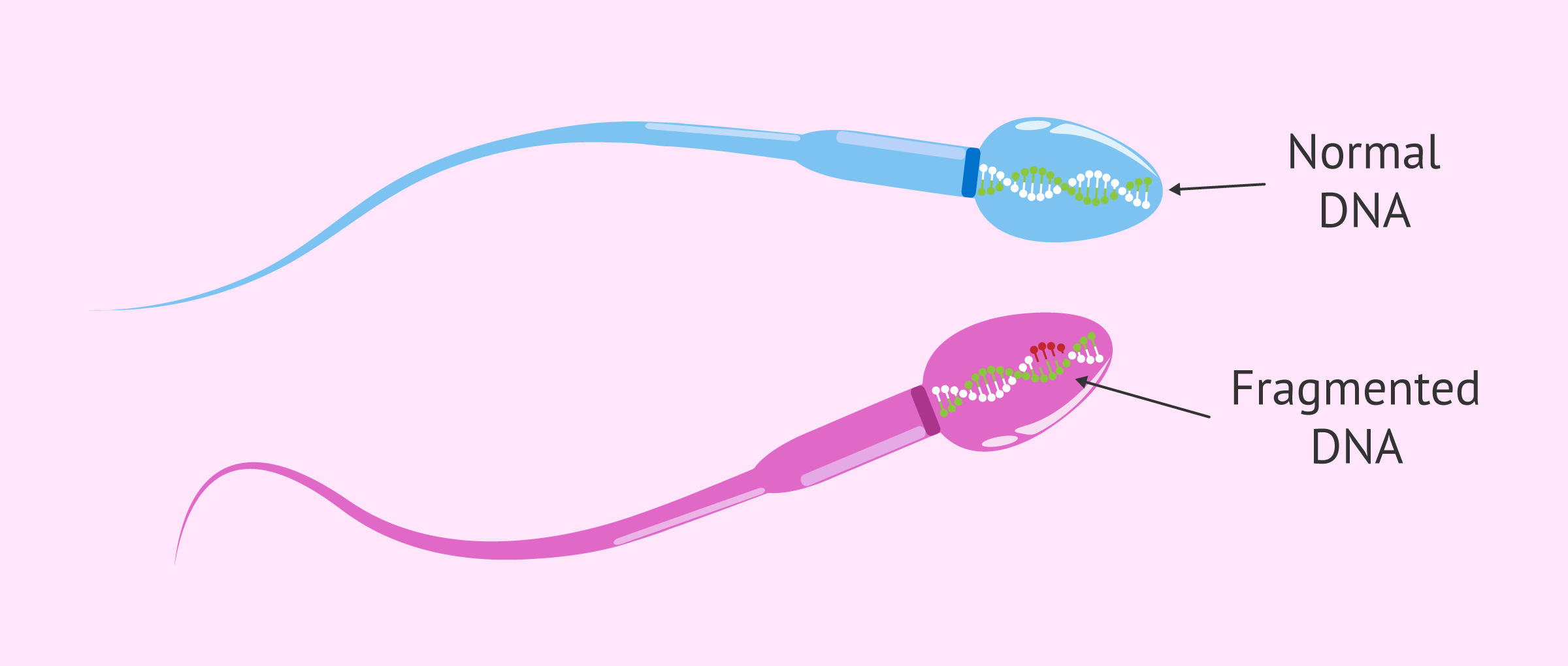 Comparison between a normal spermatozoon and an apoptotic one with fragmented DNA