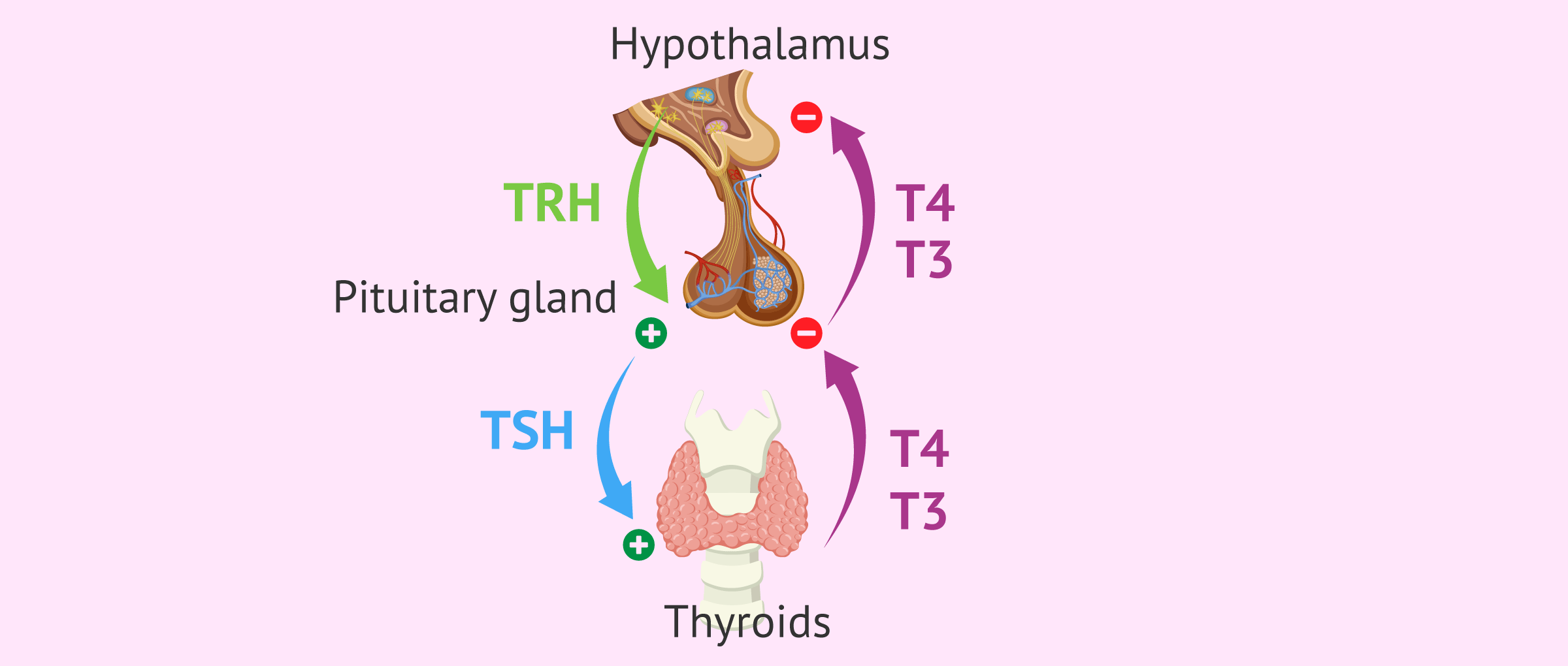 Outline of hypothyroidism