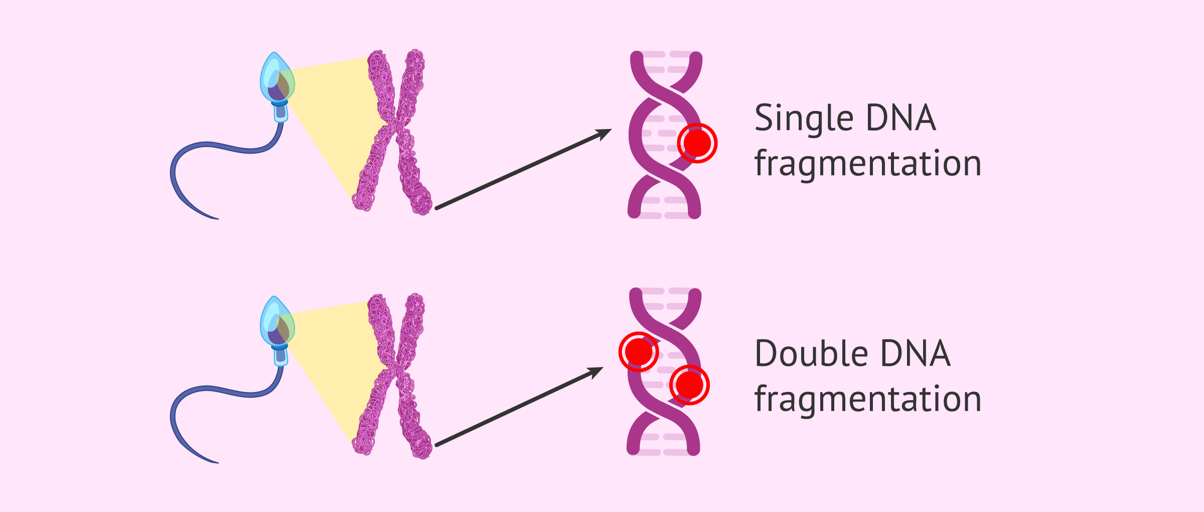 DNA Sperm Fragmentation