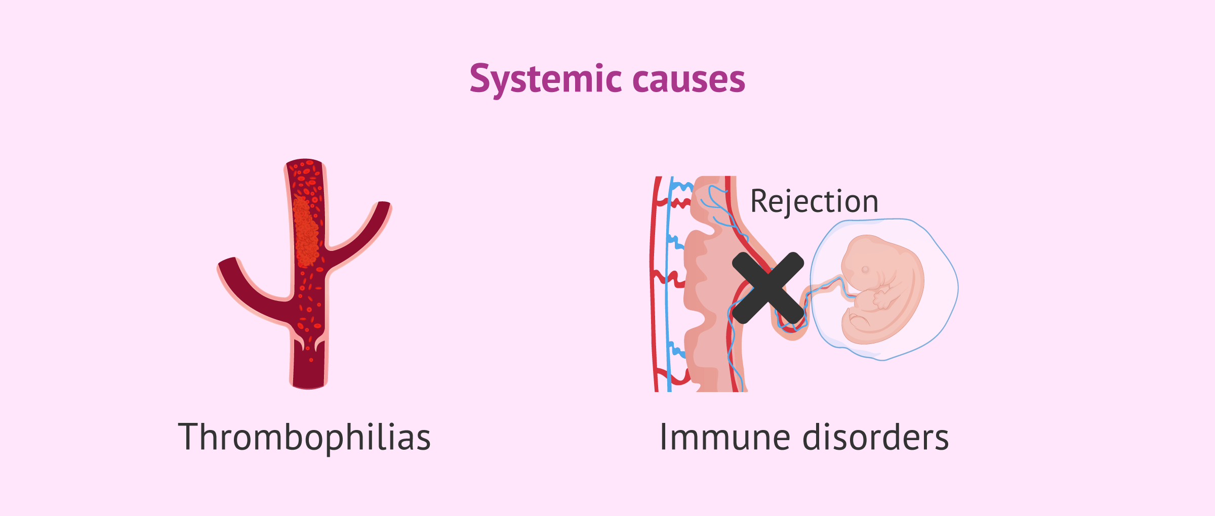 Imagen: Systemic causes of implantation failure