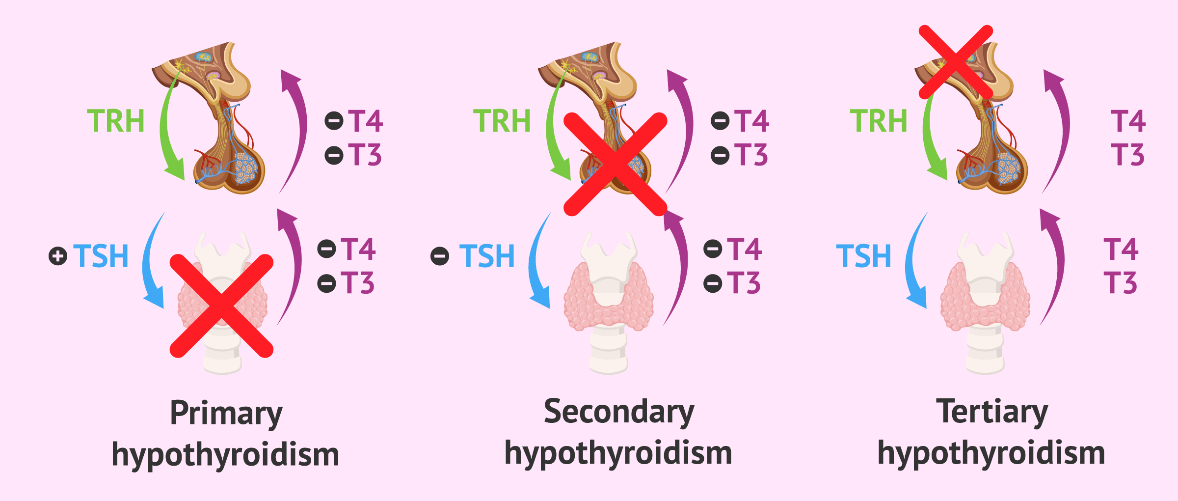 Tsh alto significado