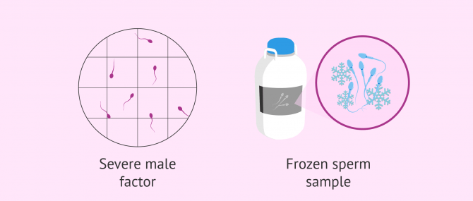 Imagen: When Fertile Chip is not useful