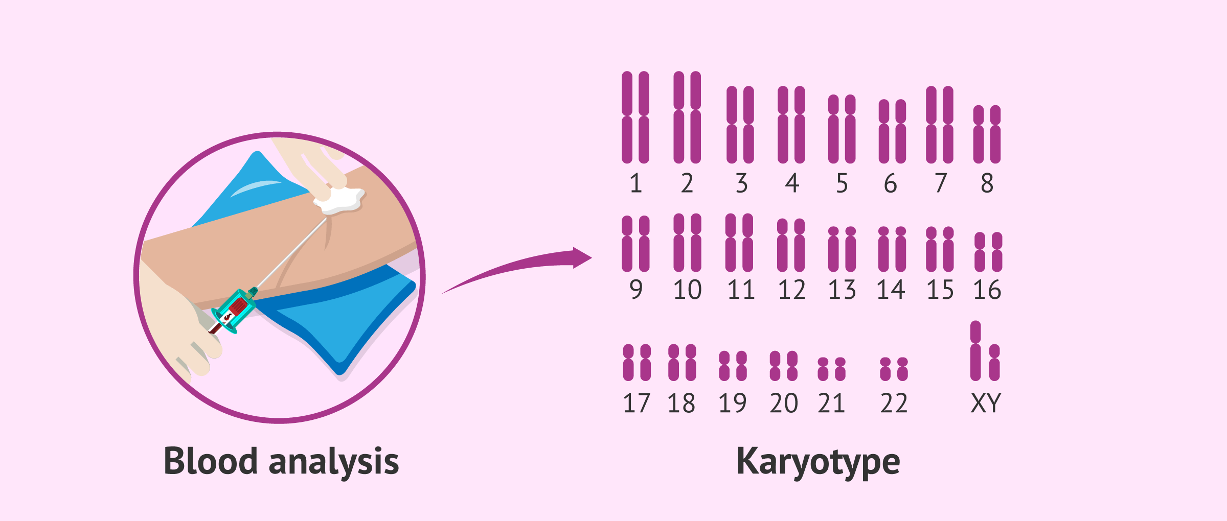 Study of the karyotype in men