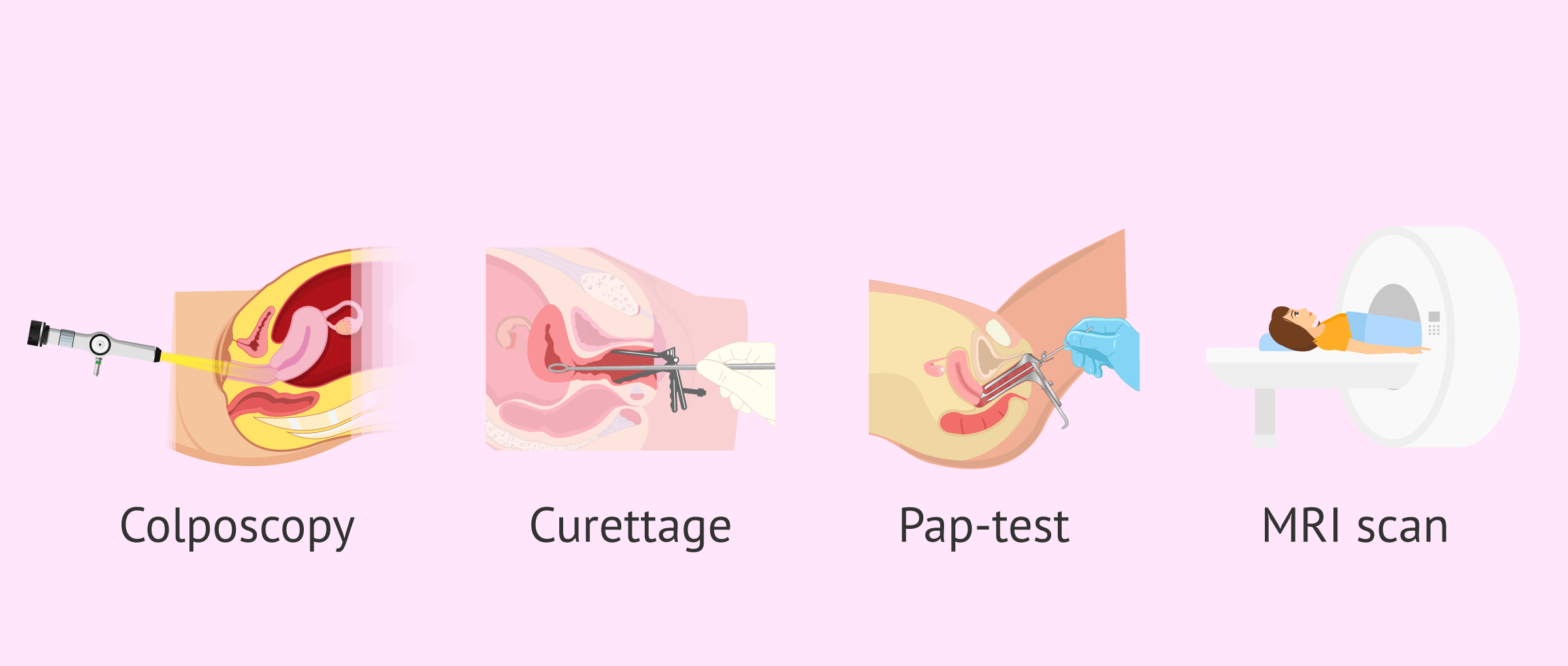 Diagnostic tests for cervical cancer