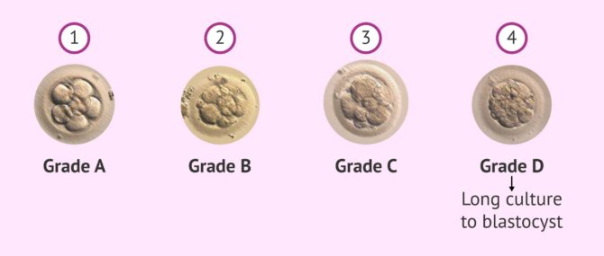 Imagen: Order to transfer embryos according to their quality
