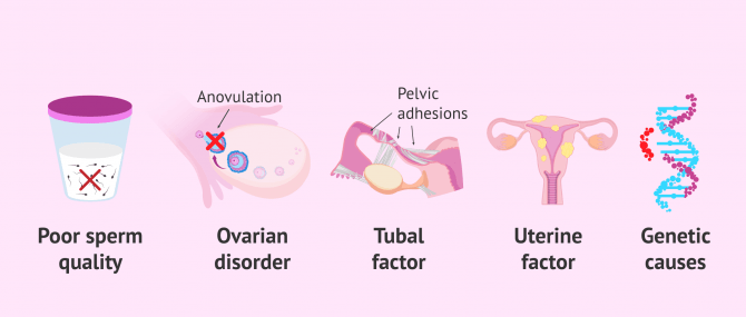 Imagen: Causes of primary infertility