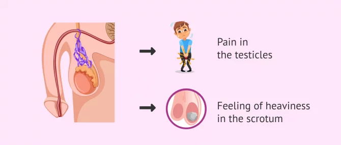 l carnitine varicocele Varicocele