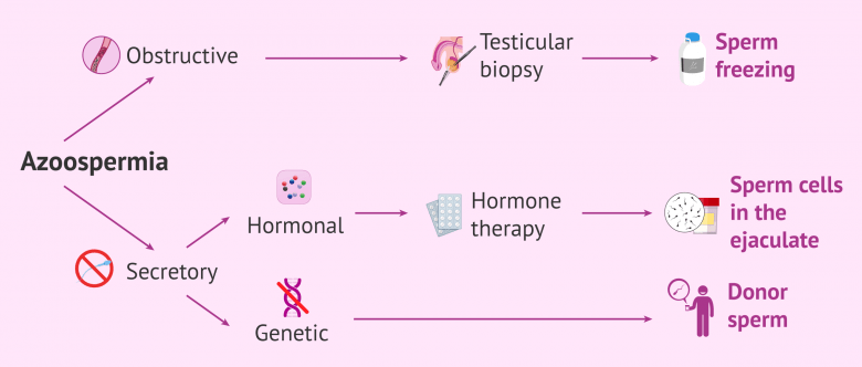 Can a Man with Azoospermia Get a Woman Pregnant?