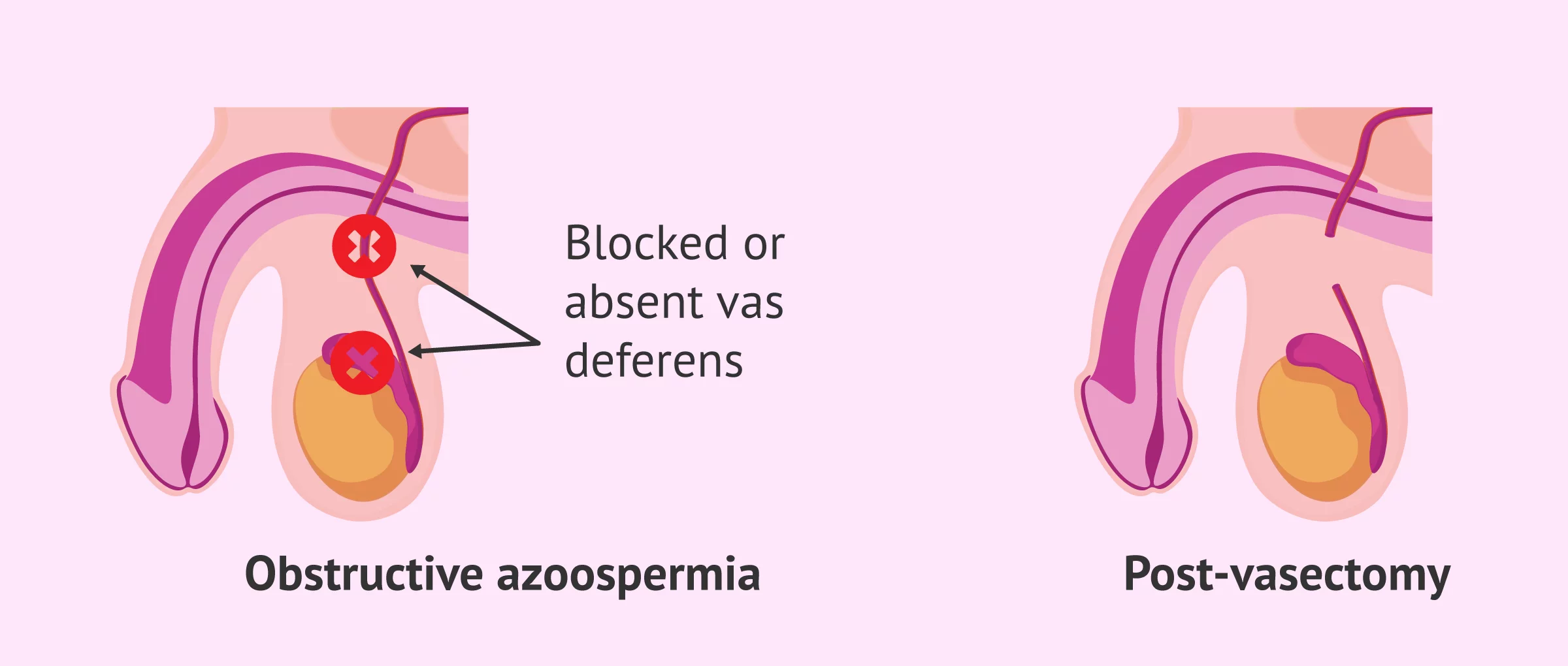 Spermatozoidlarni istemol qiluvchi Spermatozoidlarni istemol qiluvchi
