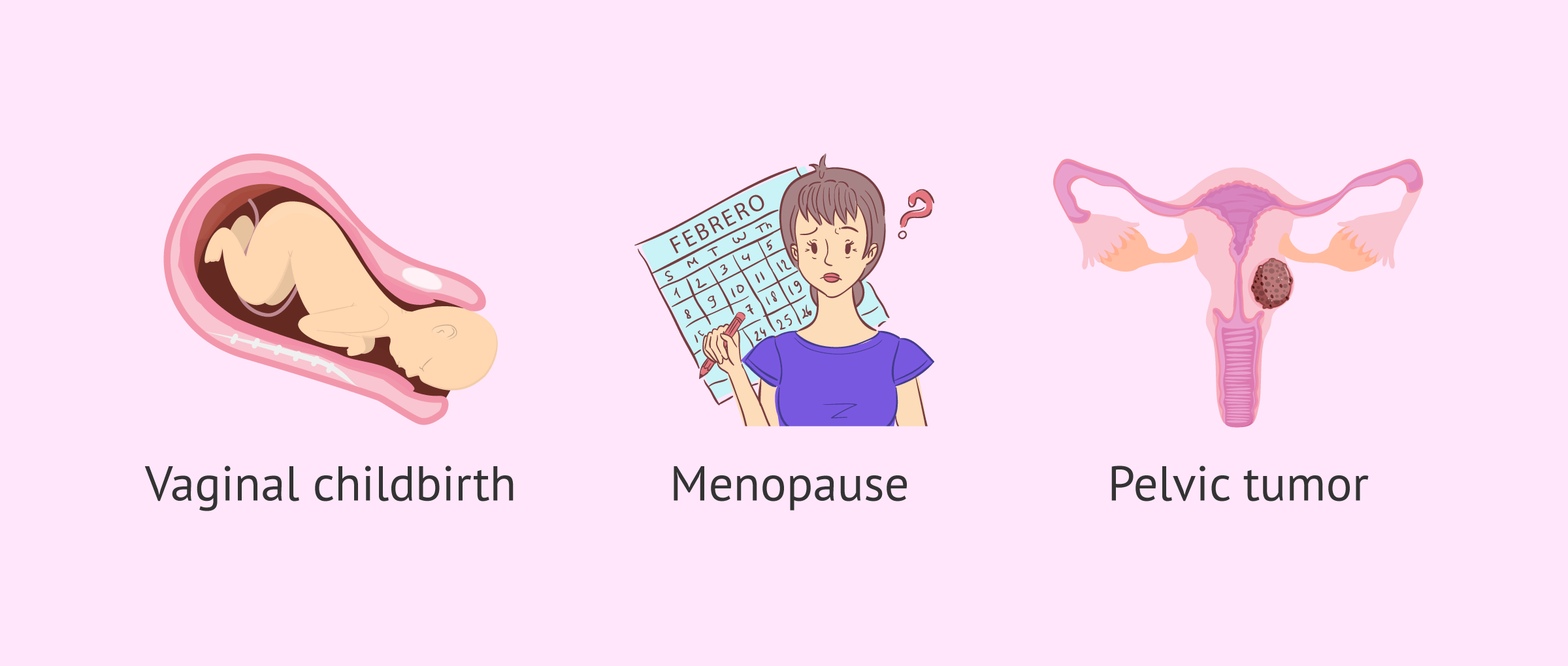 Causes of uterine prolapse