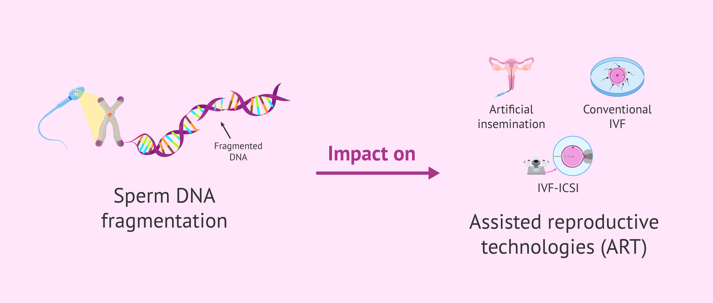 Damaged sperm DNA: impact on IVF, ICSI, and insemination