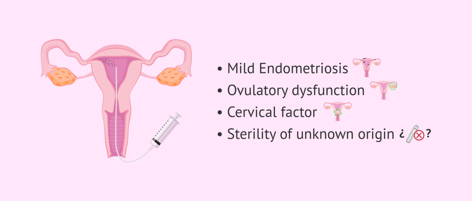 Image result for hysterectomy genetic testing for women