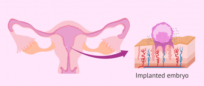 Imagen: How is embryo implantation?