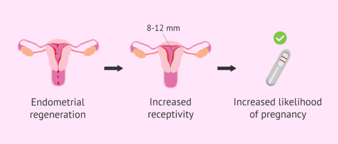 Imagen: Objectives of endometrial curettage