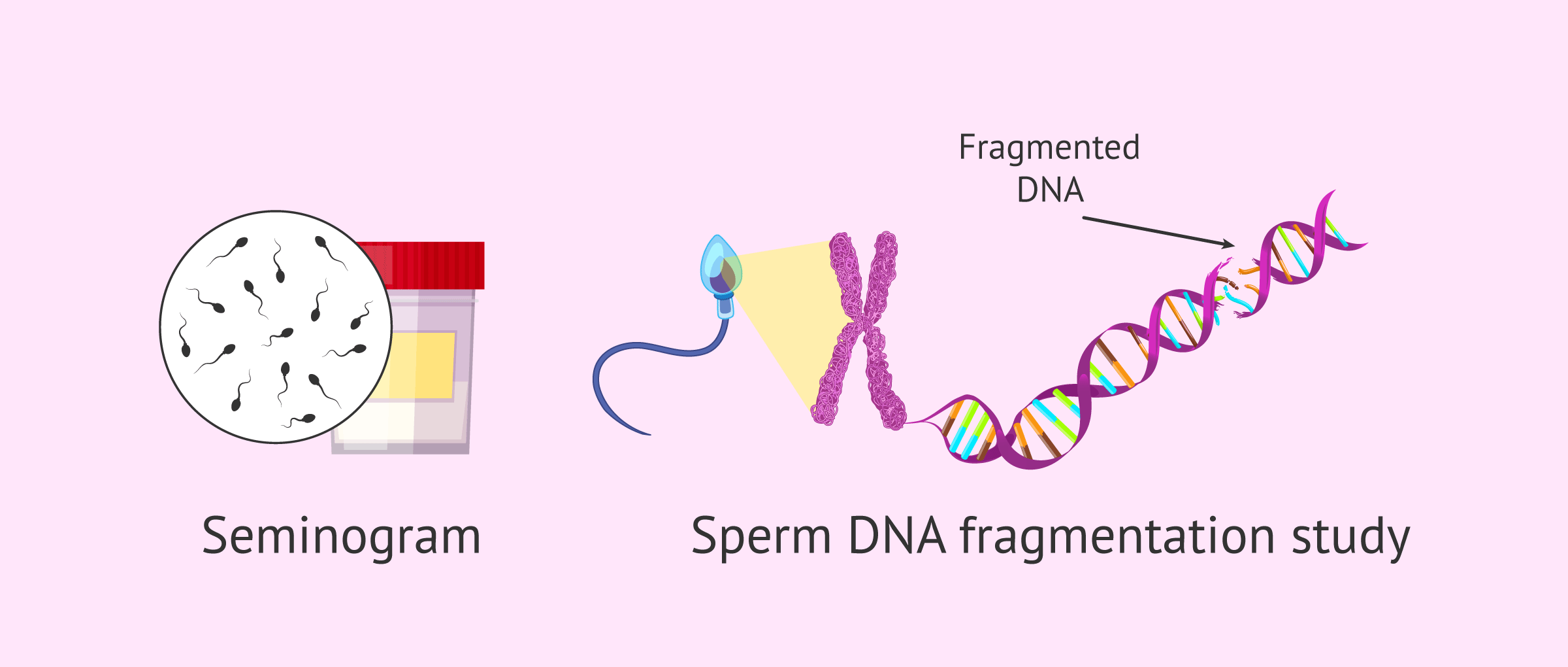 Imagen: Evaluation of Semen Quality