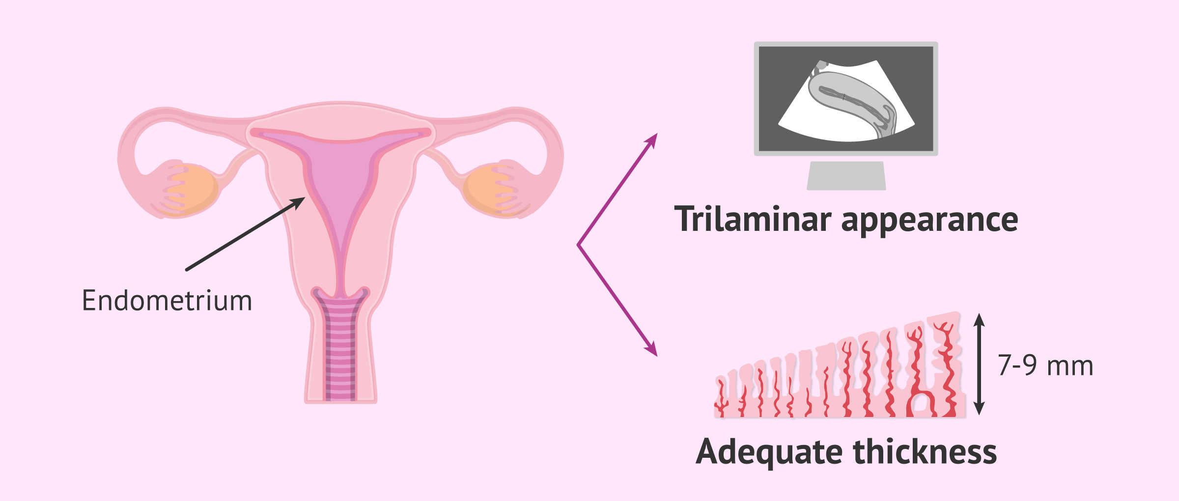 Endometrial ultrasound monitoring