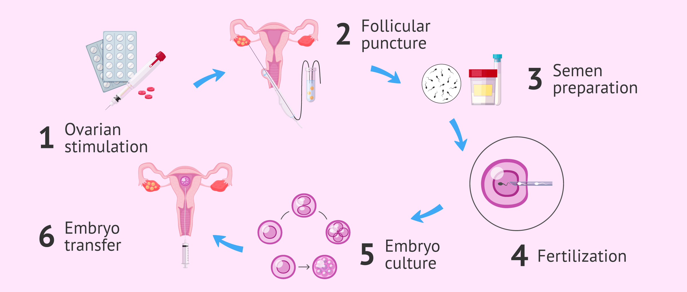Fecundacion in vitro proceso tiempo