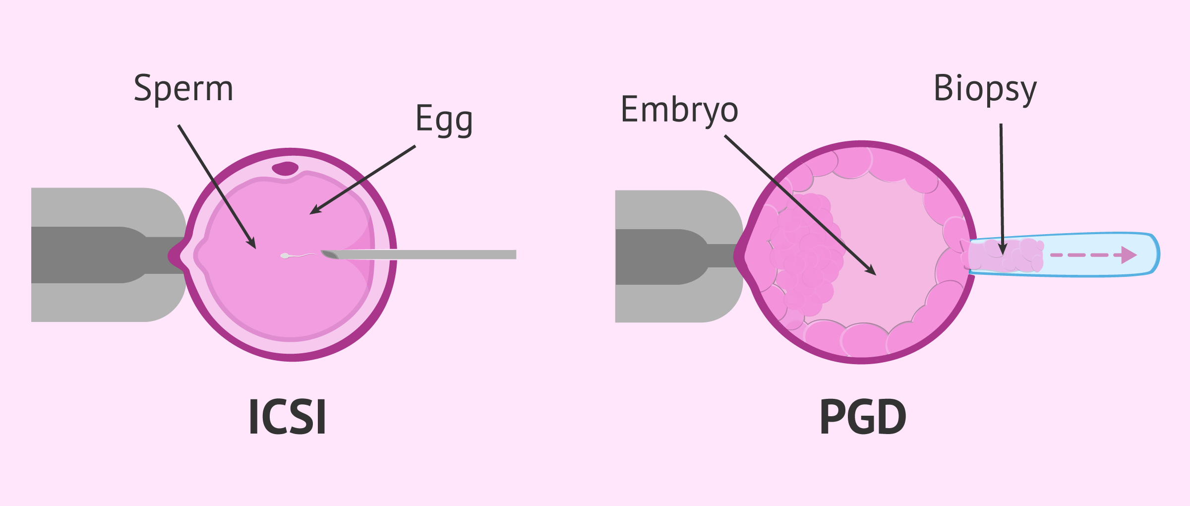 Complementary techniques in IVF