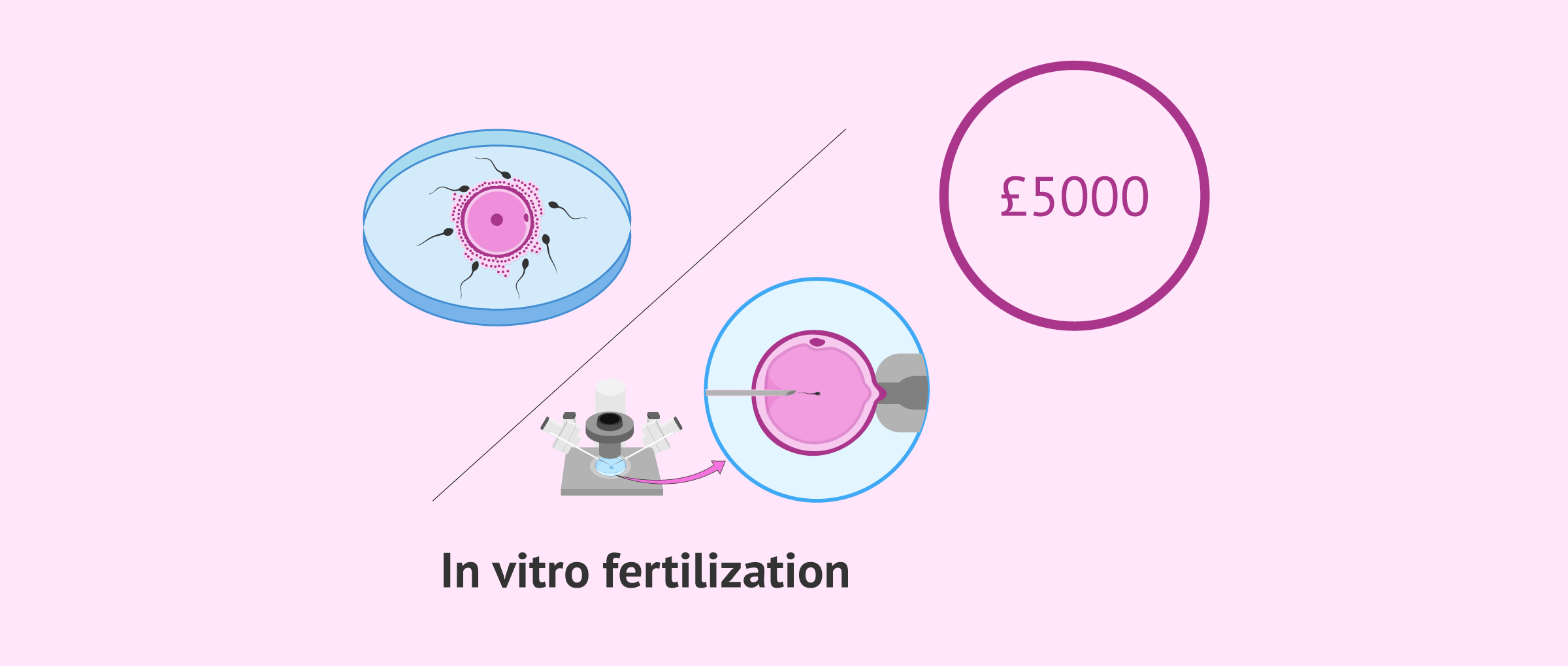 Imagen: Price of IVF in the UK