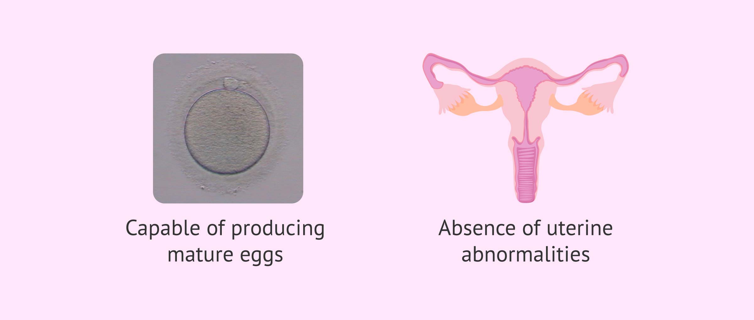 Imagen: Requirements for IVF pregnancy in women