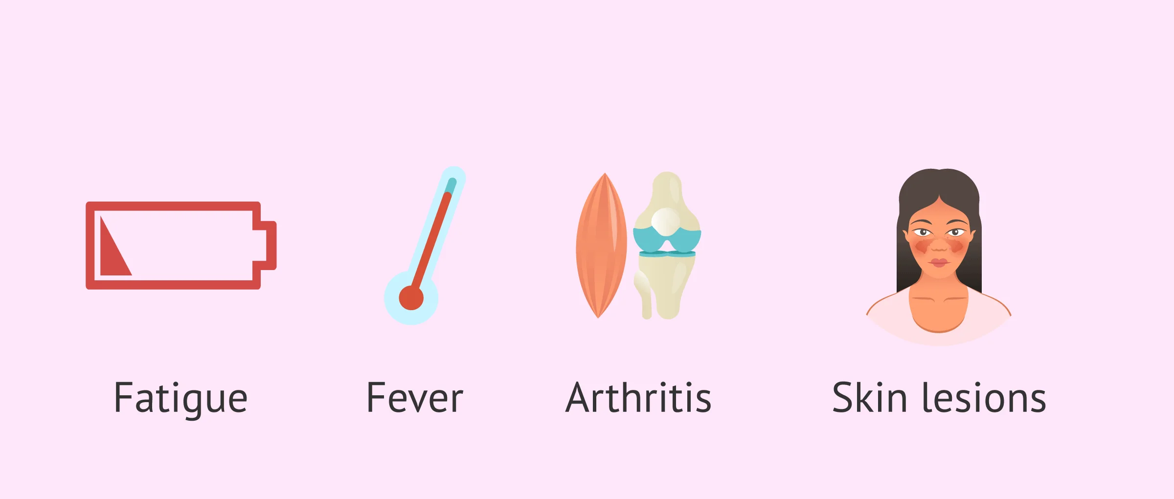 Imagen: Clinical manifestations of systemic lupus erythematosus.