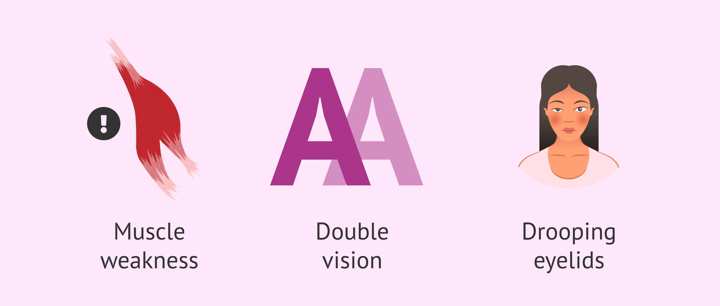 Imagen: Symptoms of Myasthenia Gravis