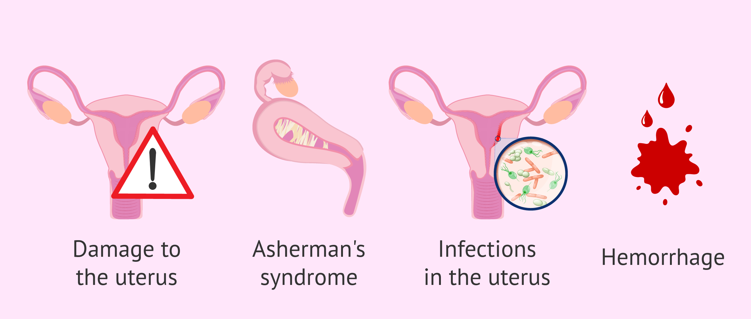 Possible complications of uterine curettage