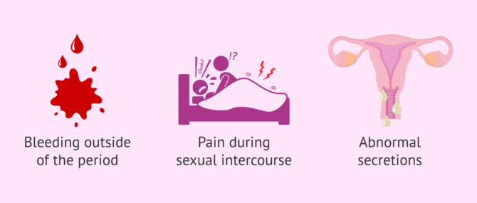 Imagen: Some symptoms of cervicitis