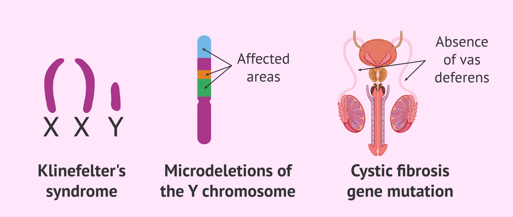 Genetic alterations causing infertility in males