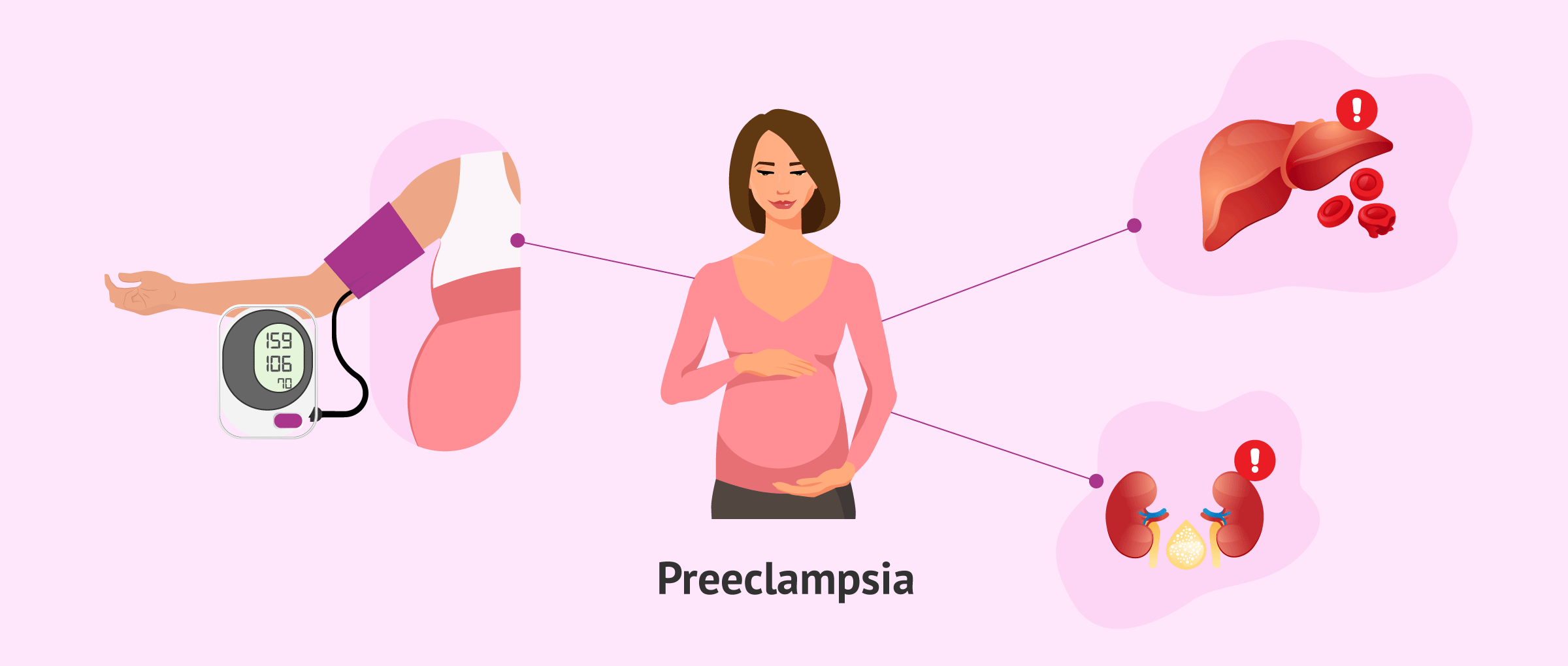 What is preeclampsia?