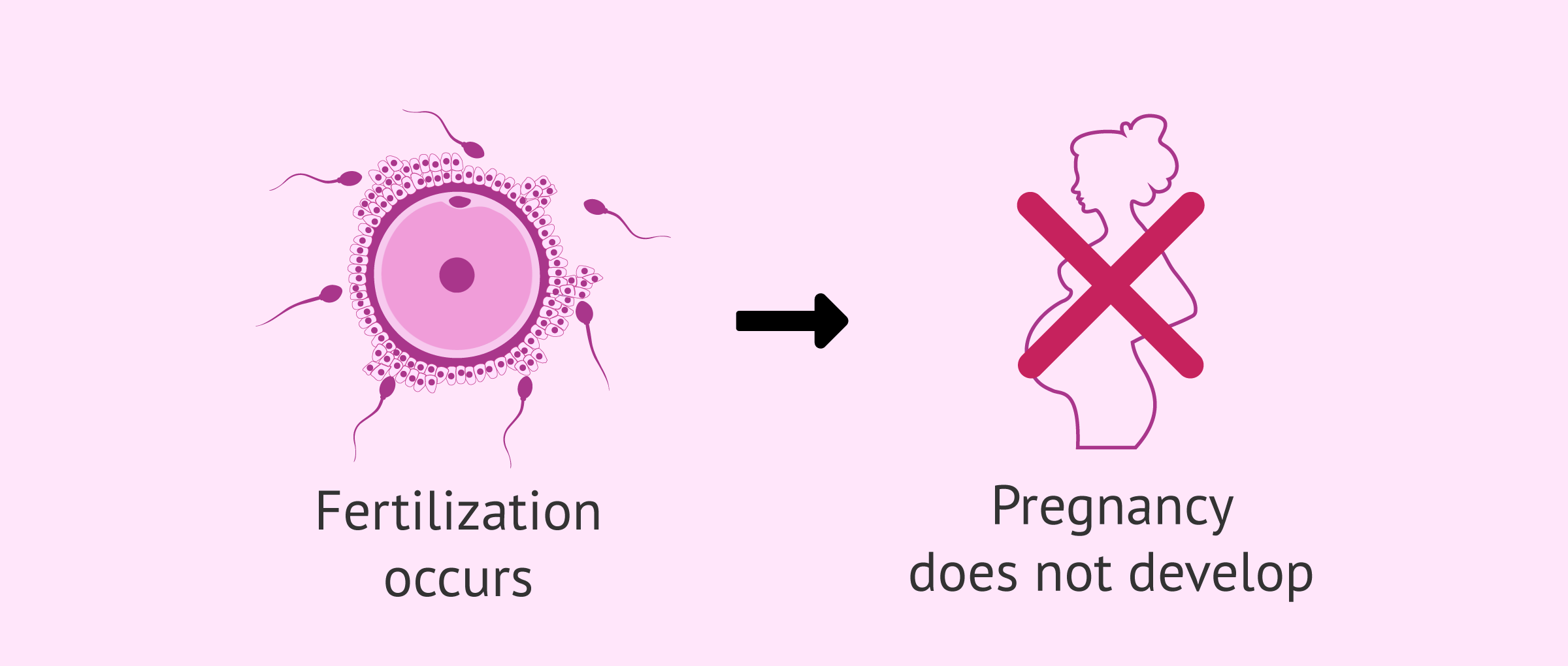 definition-infertility