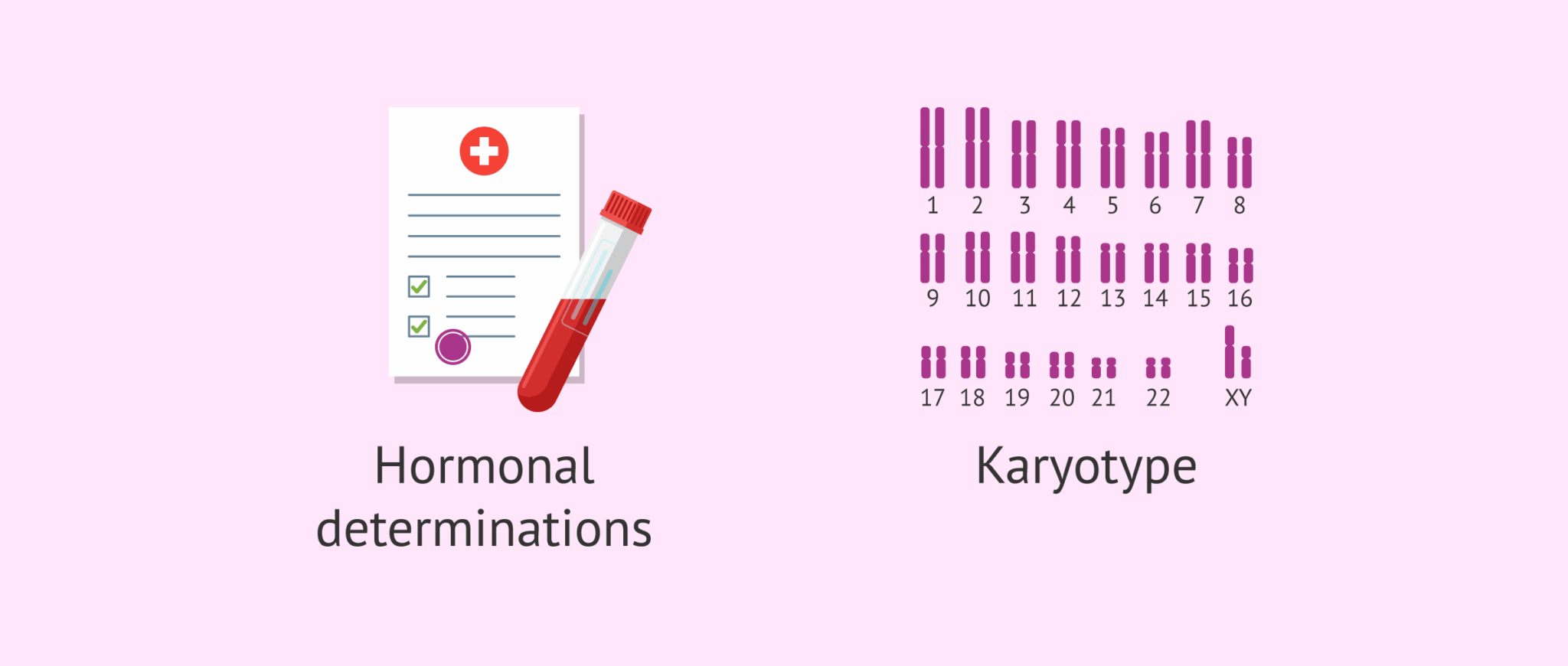 Cryptorchidism: a testicular disorder causing infertility