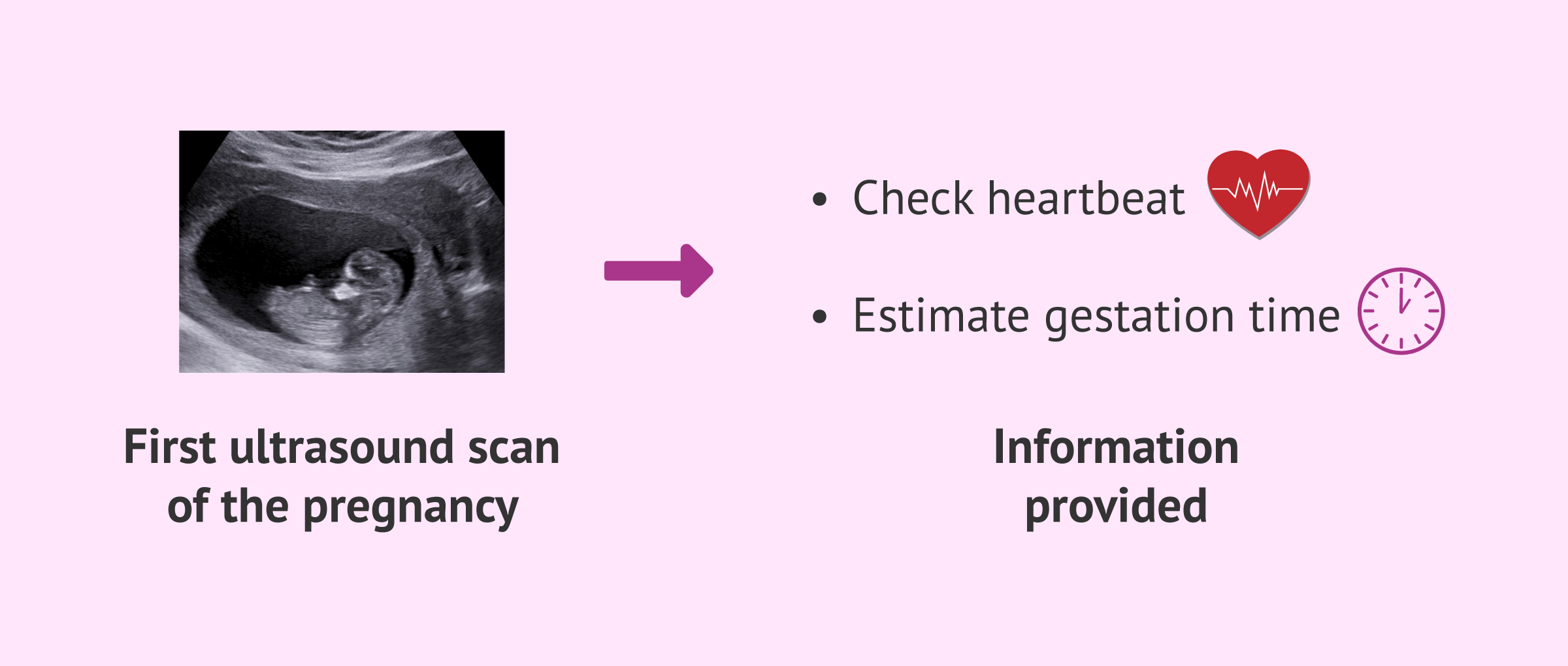 Imagen: First ultrasound at 8 weeks of gestation