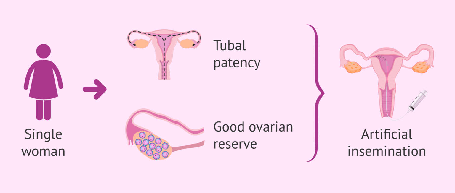 How to be a single mother? Fertility treatments and prices