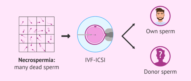 Imagen: Pregnancy with necrozoospermia