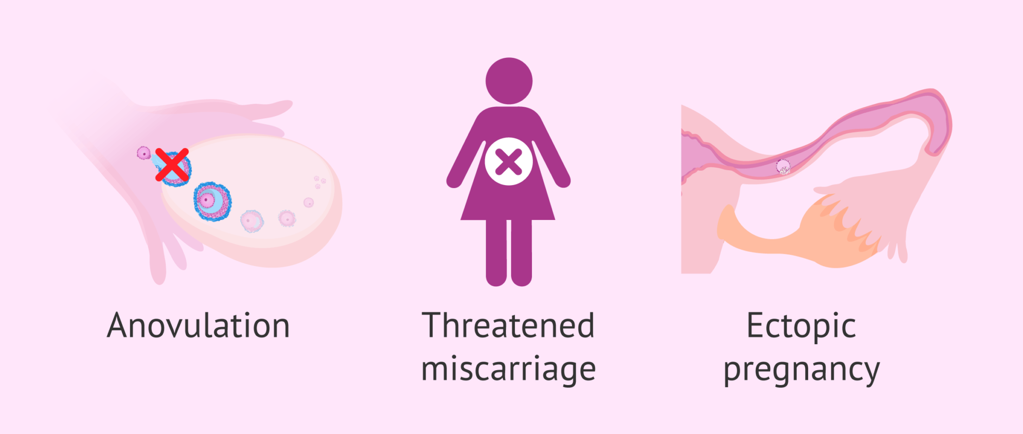Progesterone At 10 Weeks When Can You Safely Stop - 2tmut6y